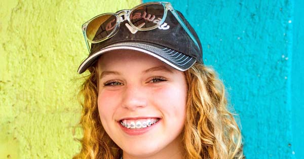 5 Signs Conveying That You Need Braces