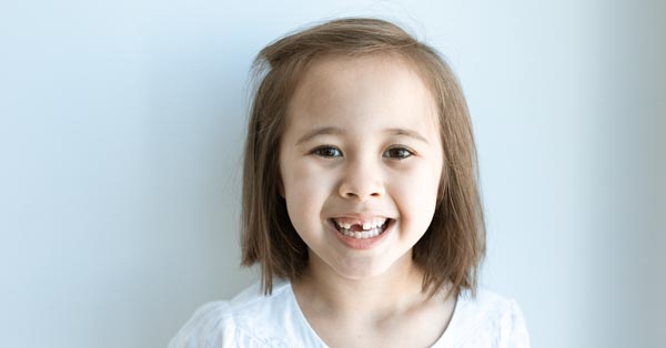 Is It Safe for Children to Receive Dental Implants?