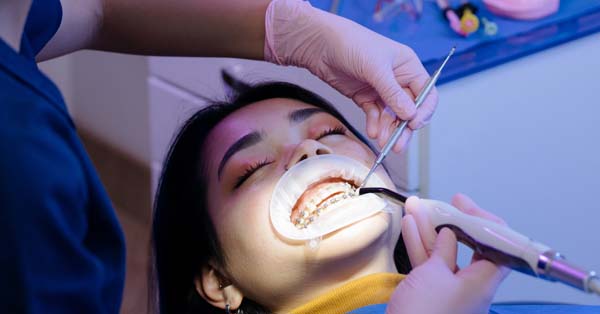 How Long Does Orthodontic Treatment Take?