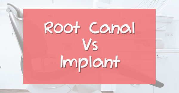 Root Canal Vs Dental Implant: Which is the Best?
